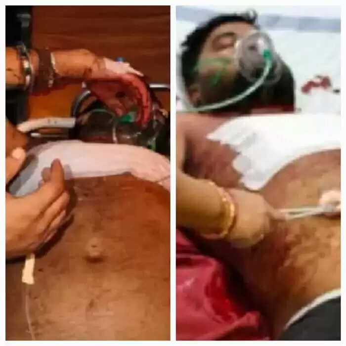 सैलून दुकान में चाकूबाजी की वारदात, दाे घायल, आराेपित फरार