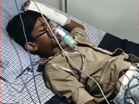 धारः पतंग उड़ाते समय 13 वर्षीय बालक को करंट लगने से बुरी तरह झुलसा