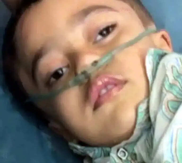बंदर&nbsp;के&nbsp;हमले&nbsp;में&nbsp;घायल&nbsp;हुए&nbsp;बच्चे&nbsp;की&nbsp;उपचार&nbsp;के&nbsp;दाैरान&nbsp;माैत