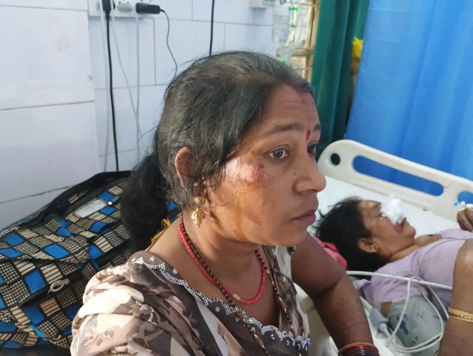 अनूपपुर: कार ने बाइक को मारी टक्कर, दो महिलाएं घायल, कार सवार हुए फरार