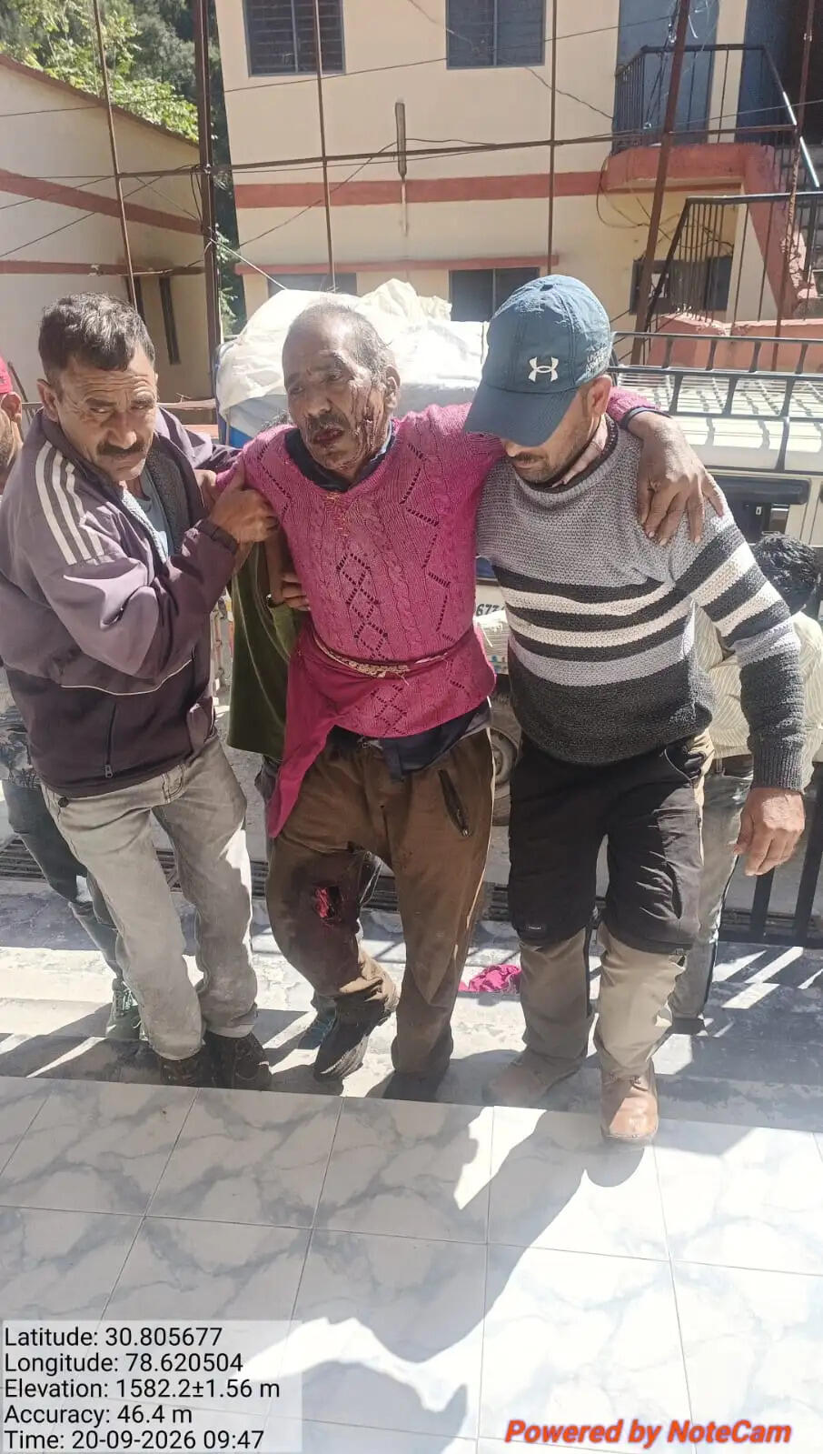 भालू के हमले से वनकर्मी घायल, हायर सेंटर रेफर