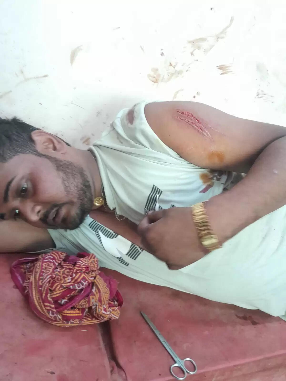 दिनदहाड़े लूटपाट, धारदार हथियार से दुकानदार घायल