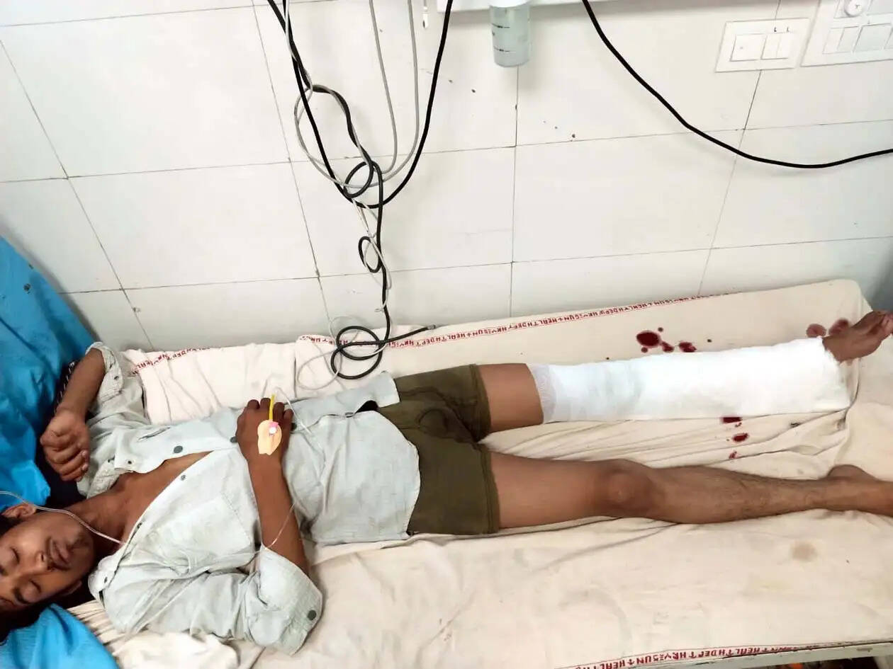 हिसार पुलिस ने मुठभेड़ में पकड़े तीन बदमाश, दो के पैर में लगी गोली