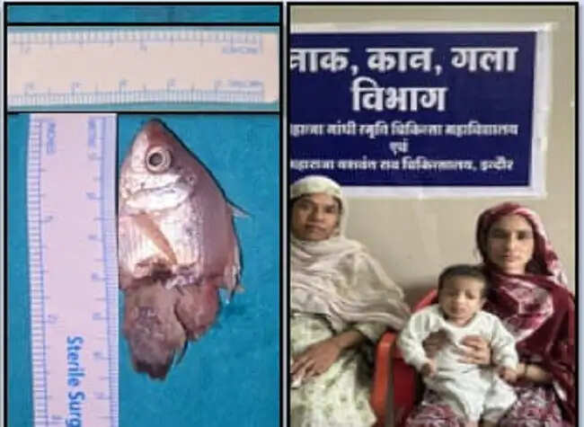 इंदौरः एमवाय अस्पताल के डॉक्टरों ने दिखाया कमाल: जटिल ऑपरेशन के बाद मासूम बच्चे को दी नई जिन्दगी