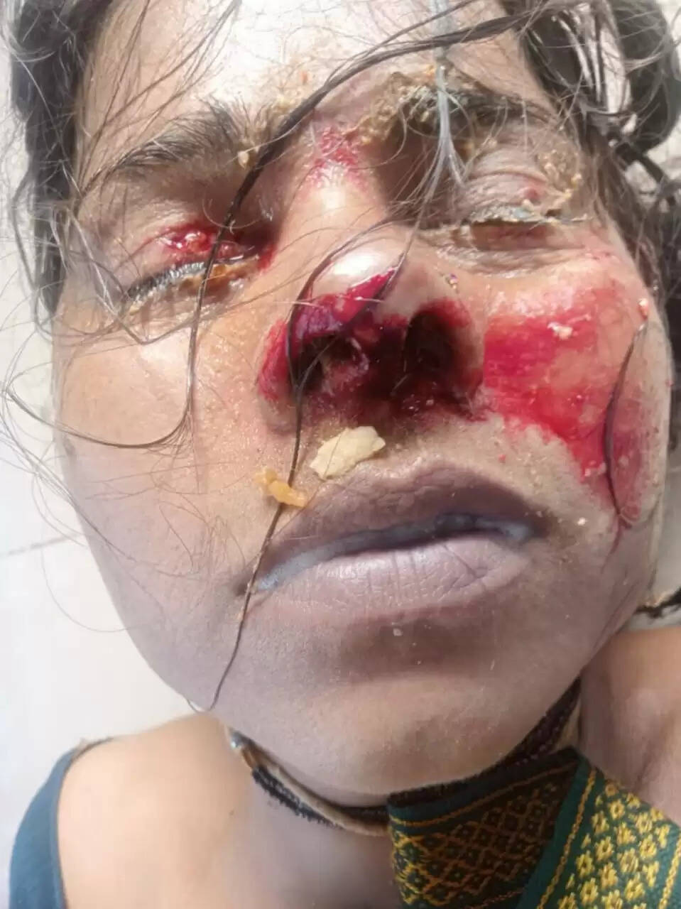 राजगढ़ः कुएं में मिला विवाहिता का शव,जांच शुरु