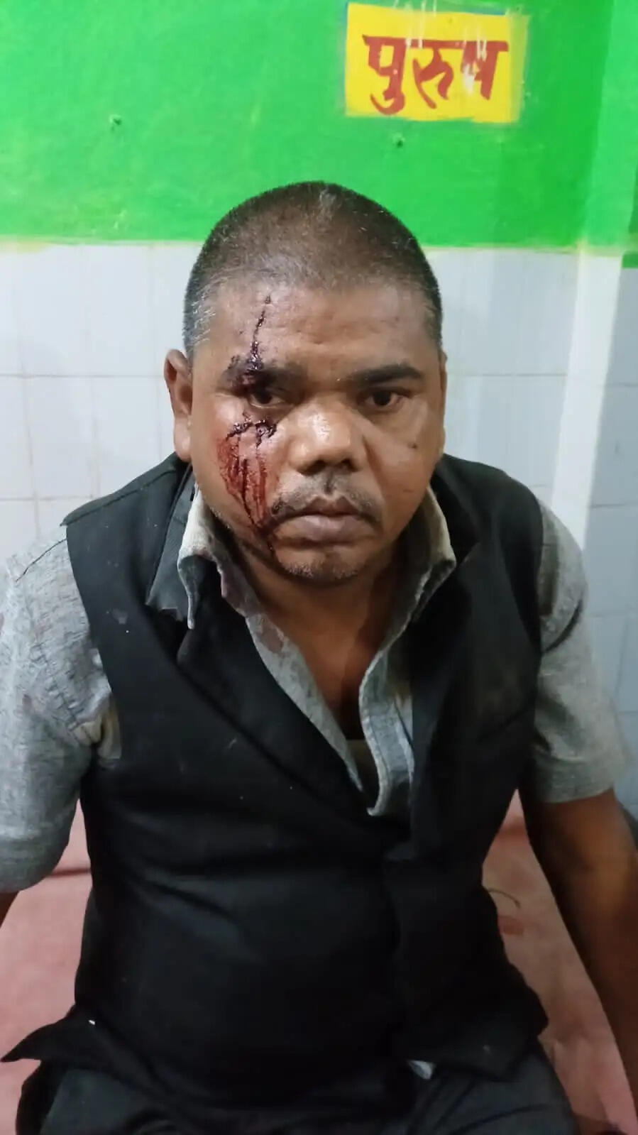 प्रयागराज-जौनपुर हाईवे पर भीषण हादसा: रोडवेज बस खड़े ट्रक से टकराई, चालक की मौत, 9 यात्री घायल