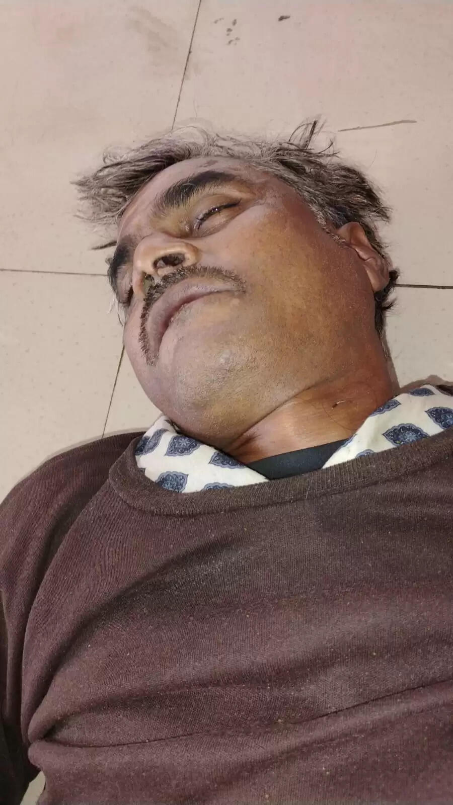 राजगढ़ः सरकारी कुएं में गिरने से व्यक्ति की मौत,जांच शुरु