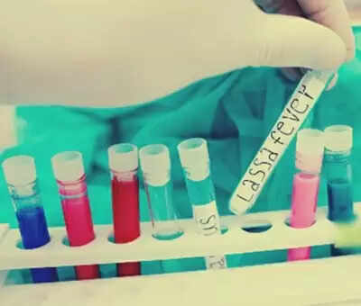 नाइजीरिया में लासा बुखार से 155 लोगों की मौत