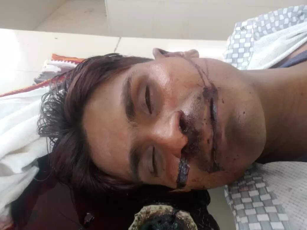 राजगढ़ःअज्ञात वाहन की टक्कर से बाइक सवार एक युवक की मौत एक घायल