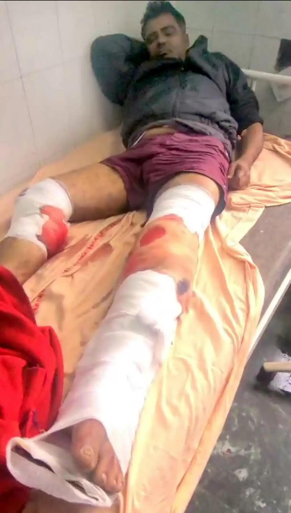 गुरुग्राम पुलिस ने मुठभेड़ में दबोचा एक लाख का इनामी बदमाश