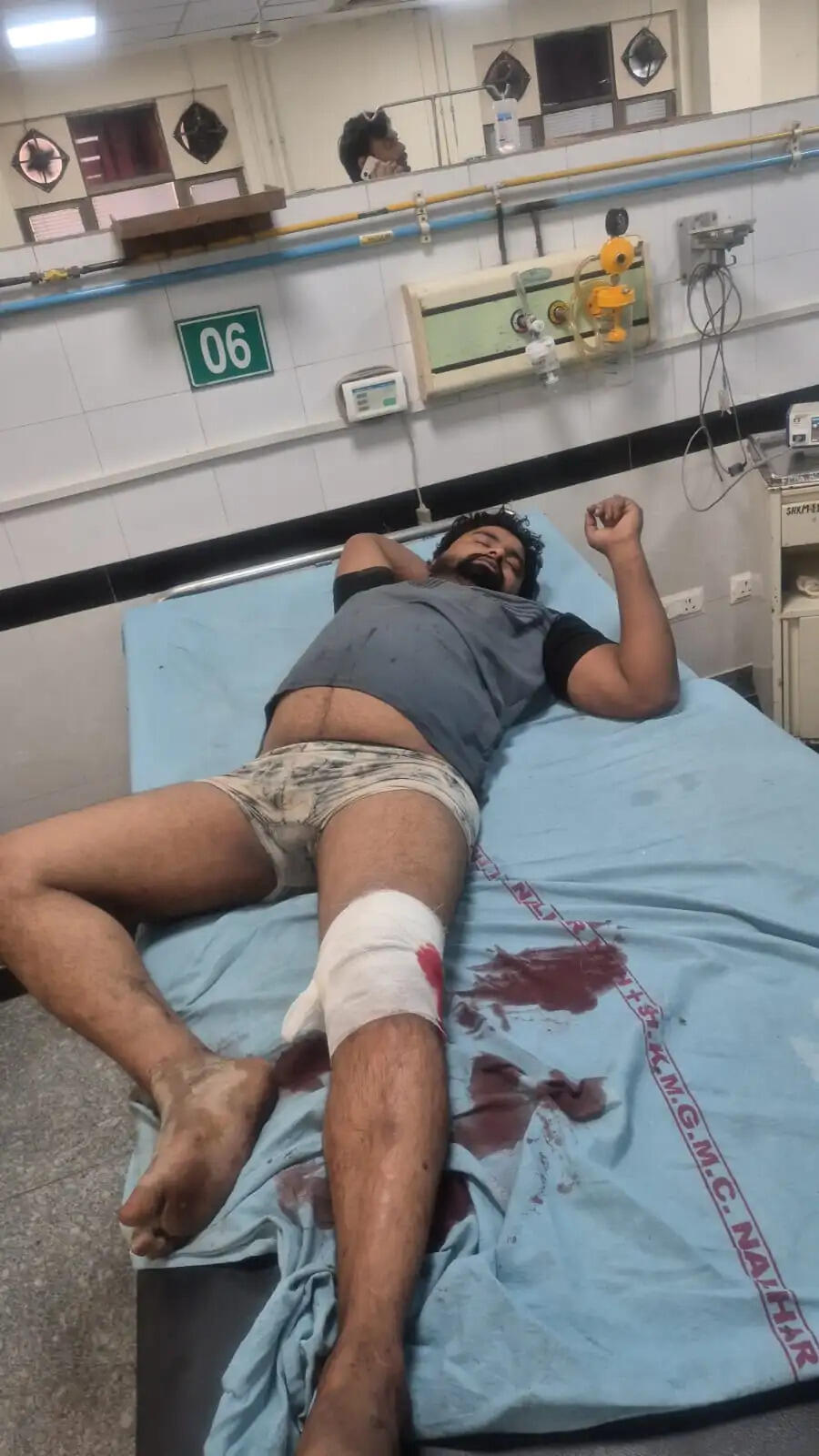 नूंह पुलिस ने मुठभेड़ में दबोचा गो-तस्कर, पांच गोवंश मुक्त