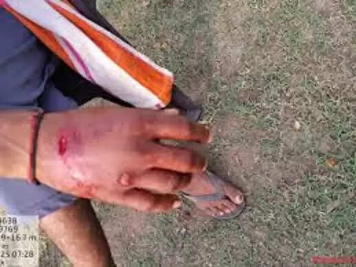 सीहोर&nbsp;के बुधनी इलाके में किसान पर बाघ ने किया&nbsp;हमला,&nbsp;हाथ पर पंजा मारा