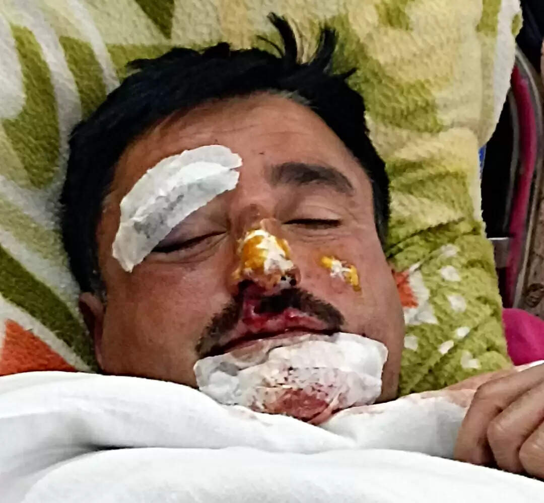 स्मैक तस्कर का पीछा कर रहा पुलिस कर्मी बाइक दुर्घटना में घायल