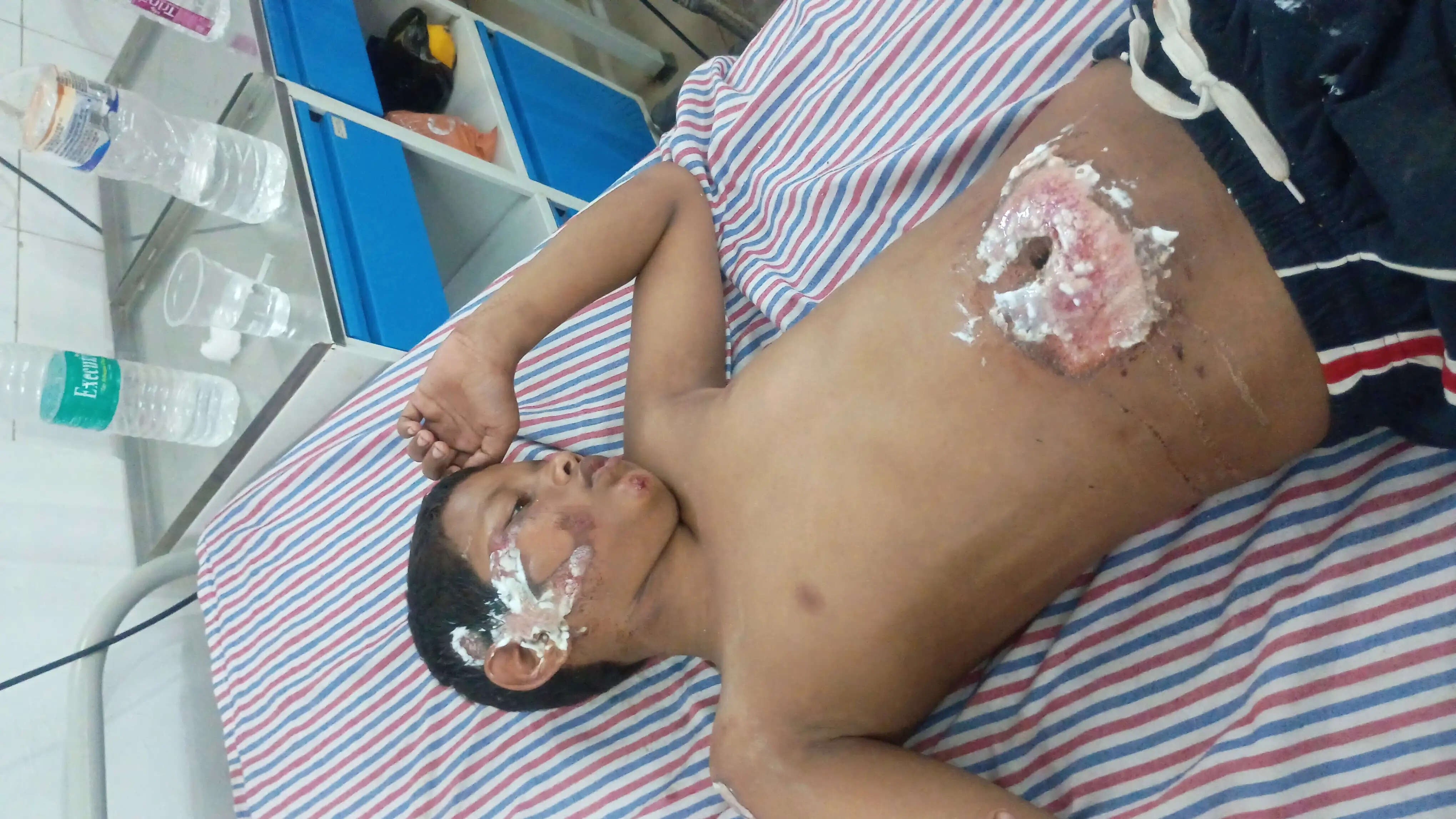 देवी दर्शन काे जा रहे 11 टेंपो सवार सड़क हादसे में घायल, मेडिकल कॉलेज में भर्ती