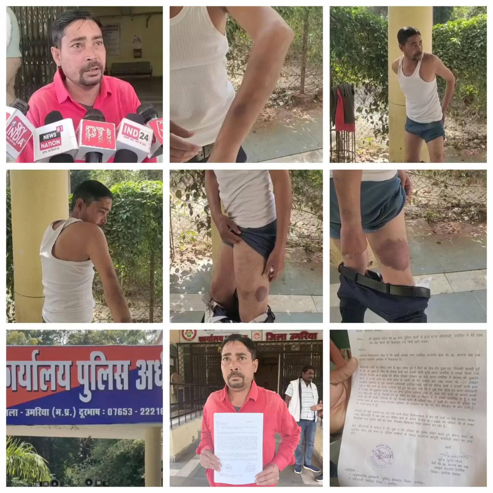 उमरिया: प्रधान आरक्षक पर कोल माइंस कर्मचारी के साथ मारपीट करने का आरोप