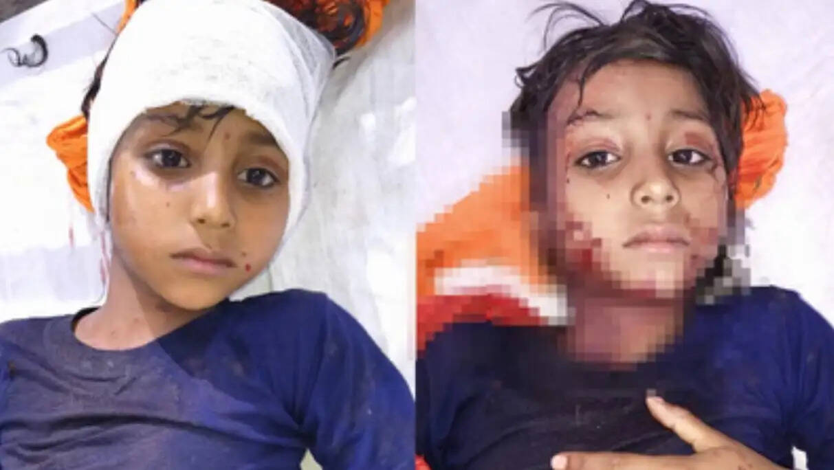 चौबीस घंटे के भीतर ही तेंदुए ने दूसरी बच्ची को बनाया निशाना