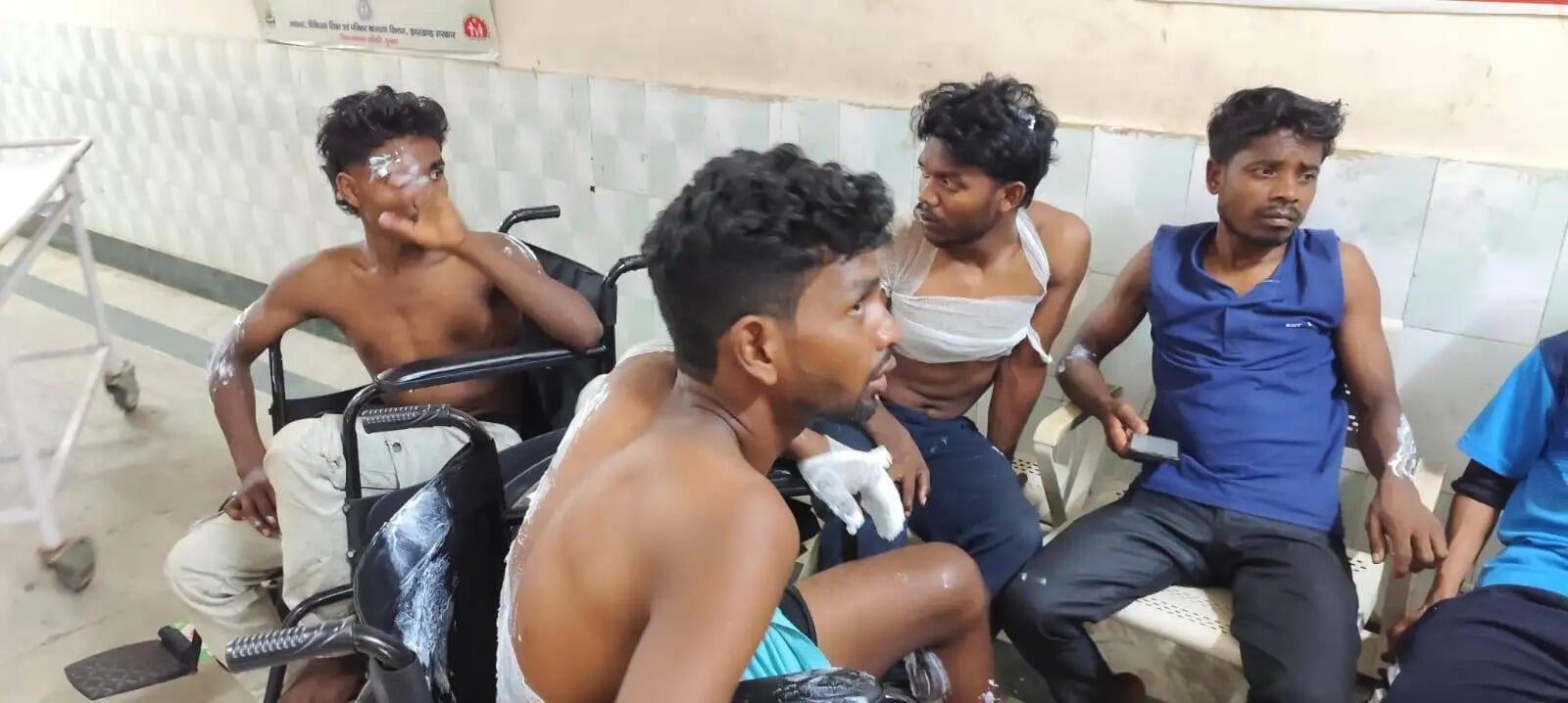 बस के छत पर नाच रहे बाराती हाई टेंशन तार के चपेट में आए, छह से अधिक झूलसे