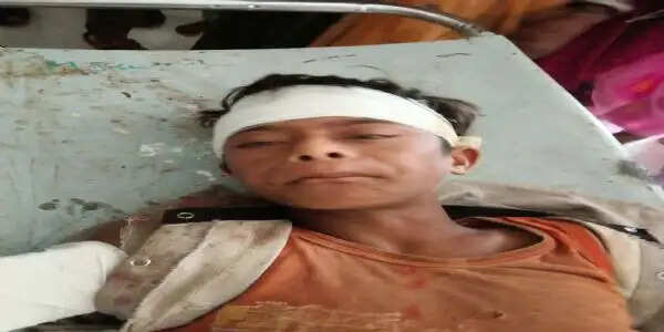 राजगढ़ः खेत में बकरी चरा रहे 10 वर्षीय बालक पर जंगली सुअर का हमला, गंभीर घायल