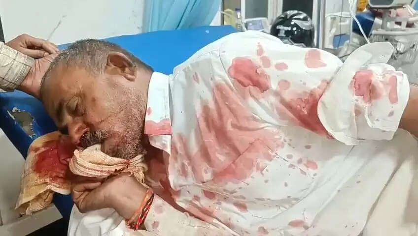 धारः दामाद ने चलाई ससुर पर गोली, छर्रे लगने से बुजुर्ग गंभीर घायल