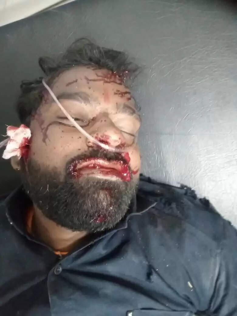 राजगढ़ः अज्ञात कार की टक्कर से बाइक चालक घायल, हालत गंभीर