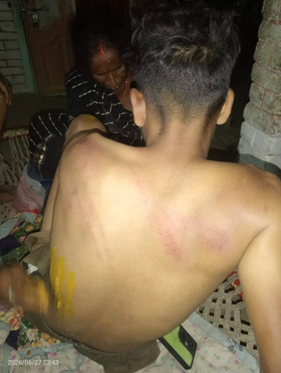 दूध देने गए दो सगे भाइयों पर जानलेवा हमला, लाठी-डंडों से पीटने के बाद ताबड़तोड़ फायरिंग में एक को लगीं तीन गोलियां