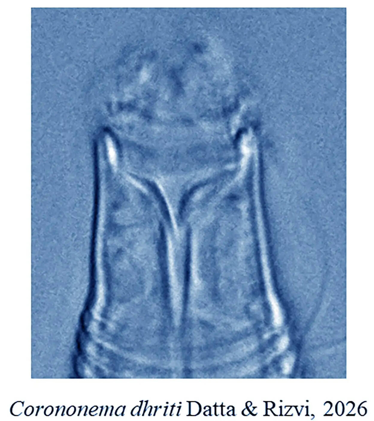 जेडएसआई के शोधकर्ताओं की बड़ी उपलब्धि, तमिलनाडु तट पर समुद्री जीवों की दो नई प्रजातियों की खोज