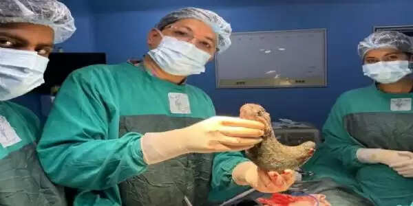 ऑपरेशन के दौरान महिला के पेट से निकला डेढ किलो बालो का गुच्छा
