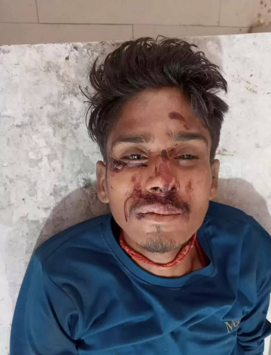 राजगढ़ःसड़क हादसे में घायल अज्ञात युवक की मौत, शिनाख्त जारी