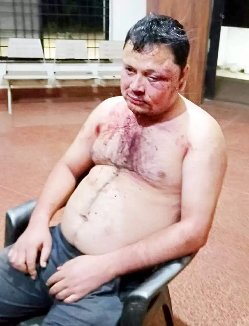 घर से अगवा कर युवक की जमकर पिटाई, भाजपा नेता पर लगाया गया आरोप