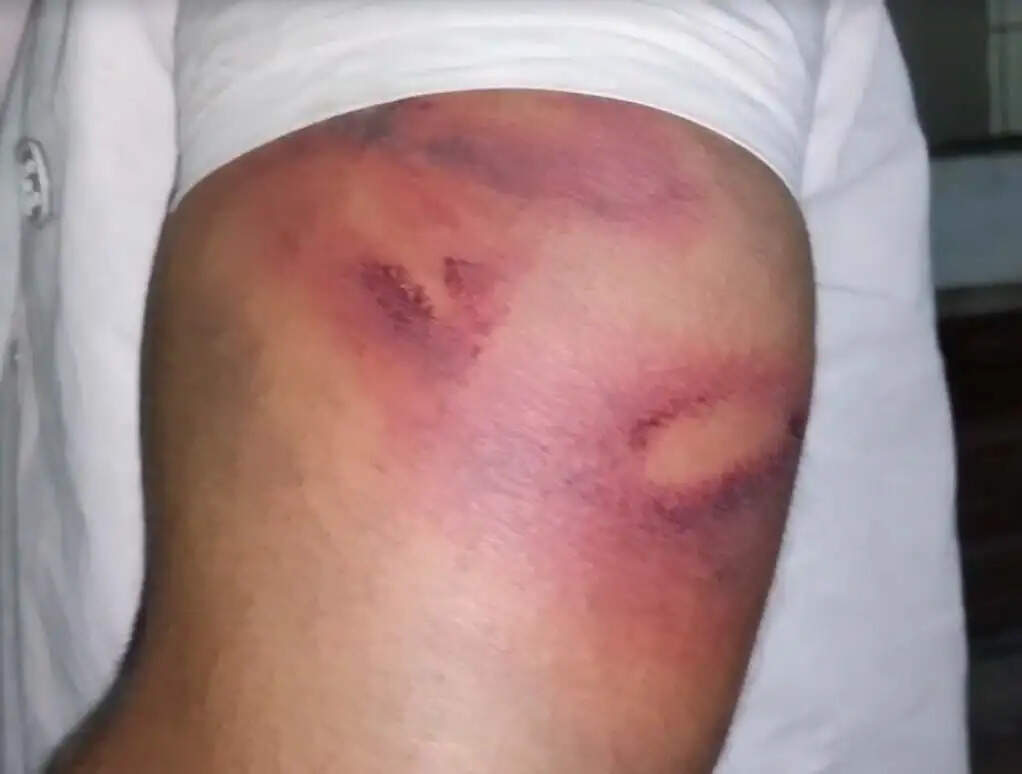 जबलपुर : भाजपा नेता की पिटाई के मामले में दो पुलिसकर्मी सस्पेंड