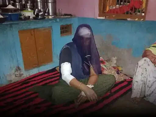 महिला पर लेपर्ड का हमला, दांतली से किया मुकाबला, तीन मिनट तक चला संघर्ष