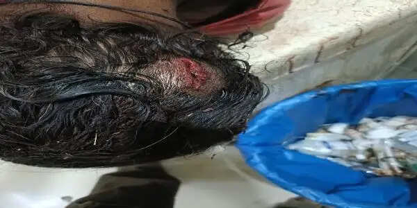 राजगढ़ः युवक पर डंडे से हमला कर चार बकरे लूट ले गए बदमाश