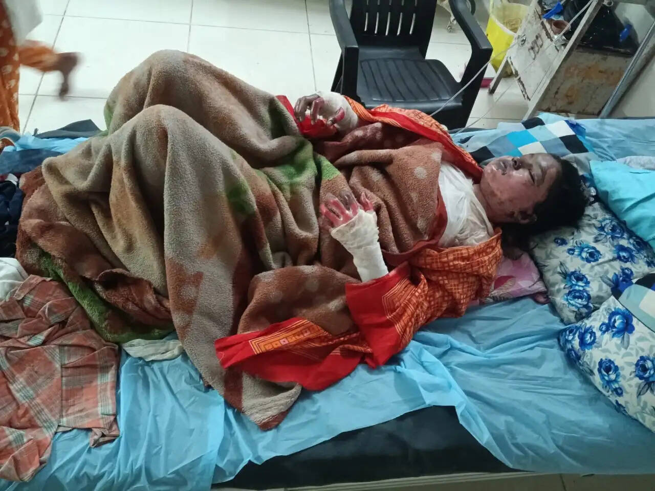 आग से झुलसी युवती गंभीर