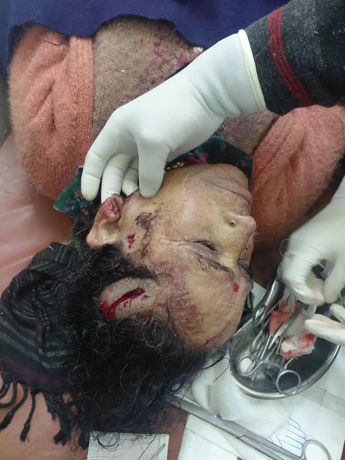 बड़कोट भालू के&nbsp; हमले में महिला घायल , ग्रामीणों में दहशत