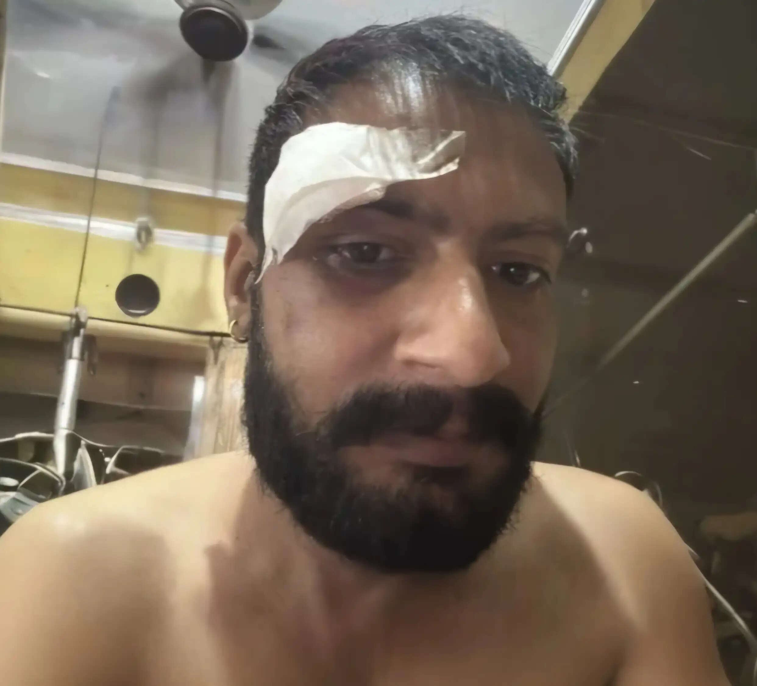 यमुनानगर: जमानत पर आए हत्या के आरोपी पर जानलेवा हमला,जांच में जुटी पुलिस