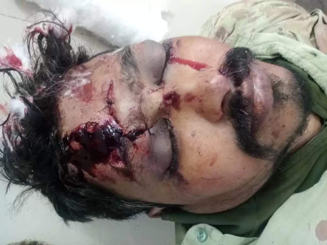 राजगढ़ः अलग-अलग जगह हुए सड़क हादसे में दो व्यक्तियों की मौत