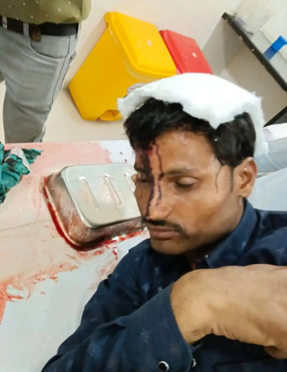 राजगढ़ः फसल काटने की बात को लेकर डंडों से मारपीट, तीन गंभीर घायल