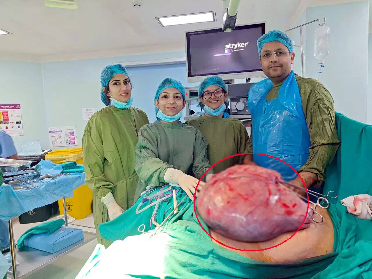 फरीदाबाद : महिला रोगी के शरीर से निकाला 15 किलो का फाइब्रॉइड ट्यूमर