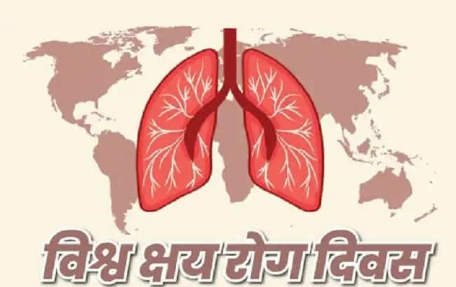 मप्र में आज विश्व क्षय दिवस पर होगा 100 दिवसीय निक्षय शिविर अभियान का शुभारंभ