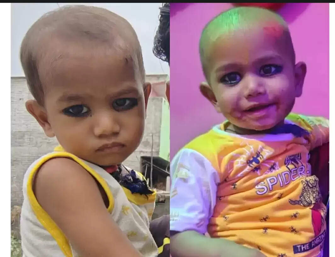 कफ सीरप पीने से दो मासूम भाइयों की बिगड़ी तबीयत, एक की मौत, दूसरा सैफई रेफर