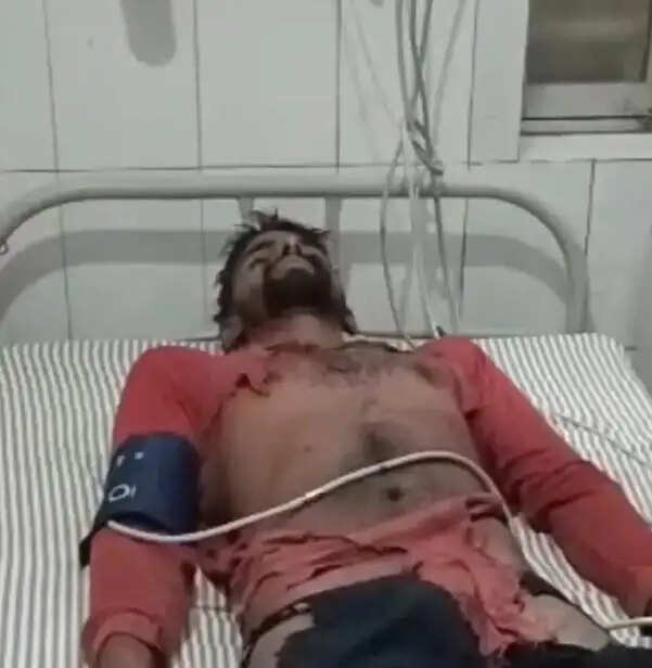 बारिश से बचने के लिए शेड में रुके ग्रामीणों पर गिरी आकाशीय बिजली, चार झुलसे , एक रेफर
