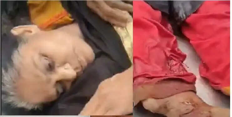कैंटर ने मारी महिला को टक्कर: पैर के ऊपर से गुजरा पिछला पहिया