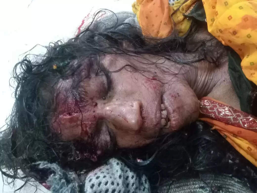 राजगढ़ः तेज रफ्तार कार की टक्कर से महिला की मौत, जांच शुरु