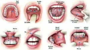 mouth ulcers