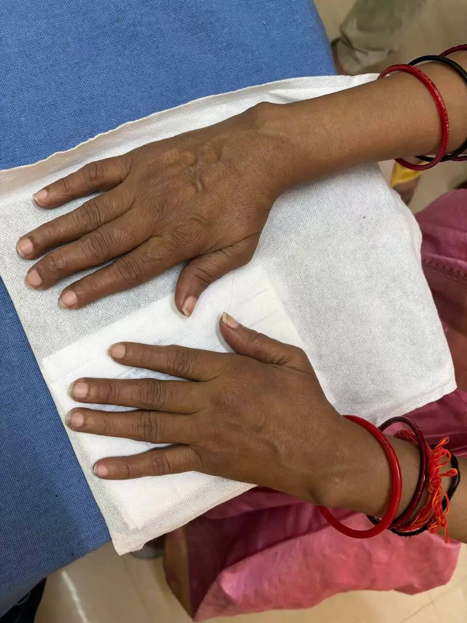 राजकीय आयुर्वेदिक महाविद्यालय में अर्थराइटिस ट्रीटमेंट एंड एडवांस्ड रिसर्च सेंटर में हो रहा इलाज़&nbsp;